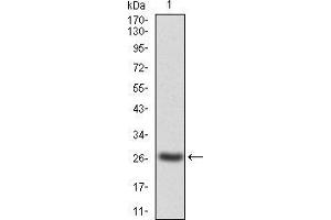 Western blot analysis using JAK2 mAb against human JAK2(AA: 745-955) recombinant protein.