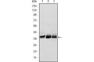 Western blot analysis using MSI2 mouse mAb against NTERA-2 (1), SW620 (2) and T47D (3) cell lysate. (MSI2 anticorps)