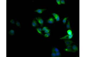 Immunofluorescence staining of Hela Cells with ABIN7127439 at 1:50, counter-stained with DAPI. (Recombinant CXCR4 anticorps)