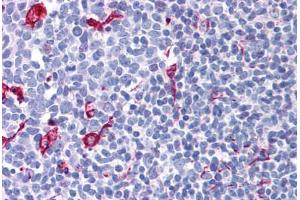 Human Tonsil (formalin-fixed, paraffin-embedded) stained with NET1 antibody ABIN299305 at 2. (NET1 anticorps  (AA 611-624))