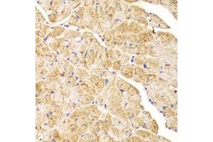 Immunohistochemistry of paraffin-embedded mouse heart using ACTN1 antibody.
