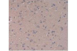 IHC-P analysis of Human Brain Tissue, with DAB staining. (TLR5 anticorps  (AA 693-858))