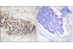 Immunohistochemistry (IHC) image for anti-Splicing Factor 1 (SF1) (Ser82) antibody (ABIN1847974)