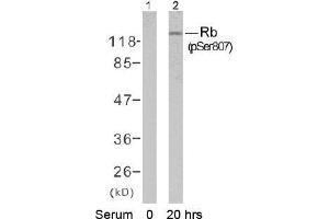Image no. 1 for anti-Retinoblastoma 1 (RB1) (pSer807) antibody (ABIN196840) (Retinoblastoma 1 anticorps  (pSer807))