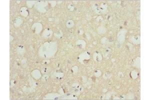 Immunohistochemistry of paraffin-embedded human brain tissue using ABIN7161608 at dilution of 1:100 (NINL anticorps  (AA 1-190))