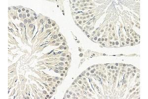 ZNF600 Mouse Monoclonal Antibody at 1/100 staining rat testis tissue by IHC-P.