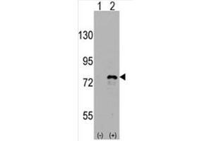Image no. 2 for anti-DEAD (Asp-Glu-Ala-Asp) Box Polypeptide 3, X-Linked (DDX3X) (C-Term) antibody (ABIN357007) (DDX3X anticorps  (C-Term))