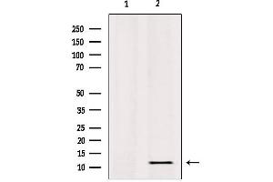 Western blot analysis of extracts from HepG2, using RPL36 Antibody. (RPL36 anticorps  (C-Term))