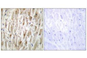 Immunohistochemistry (IHC) image for anti-LIM Domain Kinase 2 (LIMK2) (Internal Region) antibody (ABIN1849456) (LIMK2 anticorps  (Internal Region))