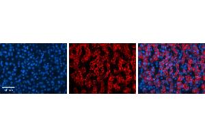 MAP2K3 antibody - C-terminal region          Formalin Fixed Paraffin Embedded Tissue:  Human Liver Tissue    Observed Staining:  Cytoplasm in hepatocytes   Primary Antibody Concentration:  1:100    Other Working Concentrations:  1/600    Secondary Antibody:  Donkey anti-Rabbit-Cy3    Secondary Antibody Concentration:  1:200    Magnification:  20X    Exposure Time:  0.