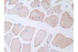 Detection of NT-ProANP in Rat Skeletal Muscle Tissue using Polyclonal Antibody to N-Terminal Pro-Atrial Natriuretic Peptide (NT-ProANP)