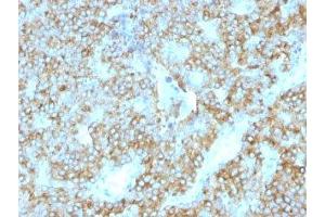 Formalin-fixed, paraffin-embedded human parathyroid stained with PTH antibody (PTH/1175). (PTH anticorps  (AA 32-115))