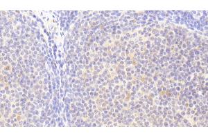 Detection of HCK in Human Lymph node Tissue using Polyclonal Antibody to Hemopoietic Cell Kinase (HCK)