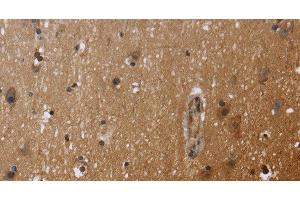 Immunohistochemistry of paraffin-embedded Human brain using FHL3 Polyclonal Antibody at dilution of 1:40
