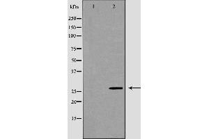 Western blot analysis of Hela whole cell lysates, using VAPB Antibody. (VAPB anticorps  (C-Term))