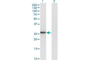 Western Blot analysis of MS4A6A expression in transfected 293T cell line by MS4A6A monoclonal antibody (M02), clone 2D12.