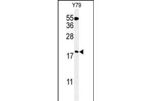 Western blot analysis of TXNDC12 Antibody (C-term) (ABIN651065 and ABIN2840056) in Y79 cell line lysates (35 μg/lane). (TXNDC12 anticorps  (C-Term))