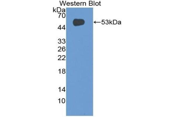 CD42a anticorps  (AA 1-189)
