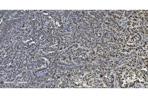 IHC analysis of Transketolase/TKT using anti-Transketolase/TKT antibody (ABIN7598958). (TKT anticorps  (AA 1-116))