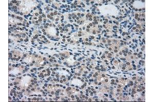 Immunohistochemical staining of paraffin-embedded Ovary tissue using anti-STK39mouse monoclonal antibody.