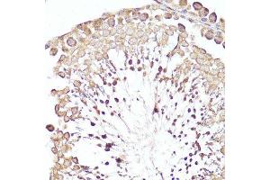 Immunohistochemistry of paraffin-embedded rat testis using MME antibody.