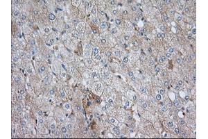 Immunohistochemical staining of paraffin-embedded Human liver tissue using anti-SNX9 mouse monoclonal antibody.