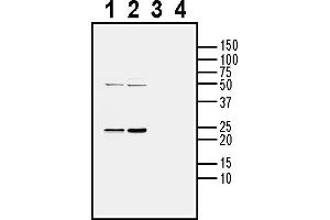 Western blot analysis of mouse brain lysate (lanes 1 and 3) and rat brain lysate (lanes 2 and 4):1-2. (CD9 anticorps  (Extracellular))