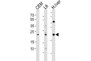Western blot analysis of lysates from CEM, rat L6 cell line and human liver tissue lysate(from left to right), using PEMT Antibody (N-term) (ABIN650614 and ABIN2844055). (PEMT anticorps  (N-Term))