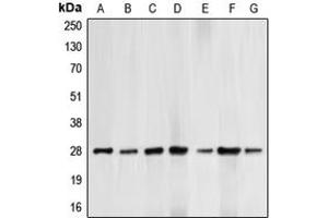 Western blot analysis of BCL2 (pT69) expression in HepG2 UV-treated (A), HeLa (B), HL60 (C), THP1 (D), Jurkat paclitaxel-treated (E), NIH3T3 H2O2-treated (F), PC12 H2O2-treated (G) whole cell lysates. (Bcl-2 anticorps  (pSer69))