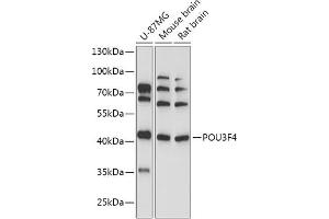Western blot analysis of extracts of various cell lines, using POU3F4 antibody (ABIN7269496) at 1:1000 dilution.