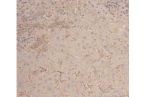 Detection of ACTG in Human Liver Tissue using Polyclonal Antibody to Gamma Actin (ACTG)