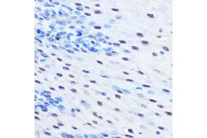 Immunohistochemistry of paraffin-embedded human esophageal using Phospho-ST-S727 Rabbit pAb (ABIN6135319, ABIN6136254, ABIN6136255 and ABIN6225478) at dilution of 1:100 (40x lens).