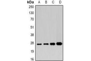 Western blot analysis of APIP expression in 22RV1 (A), mouse heart (B), mouse liver (C), rat stomach (D) whole cell lysates. (APIP anticorps)