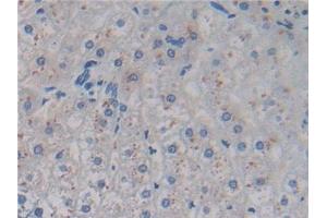 Detection of AMH in Human Liver Tissue using Monoclonal Antibody to Anti-Mullerian Hormone (AMH) (AMH anticorps)
