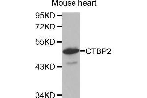 Western Blotting (WB) image for anti-C-terminal Binding Protein 2 (CTBP2) (C-Term) antibody (ABIN1679396) (CTBP2 anticorps  (C-Term))