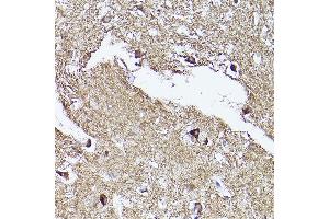 Immunohistochemistry of paraffin-embedded human brain using VD Rabbit pAb (ABIN7271337) at dilution of 1:150 (40x lens).