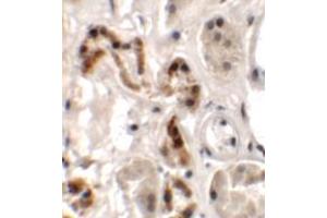 Immunohistochemistry of DBX1 in human kidney tissue with DBX1 antibody at 2. (DBX1 anticorps  (Middle Region))