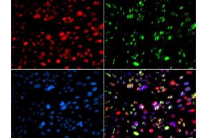 Immunofluorescence analysis of GFP-RNF168 transgenic U2OS cells using PNKP antibody. (PNKP anticorps  (AA 60-320))
