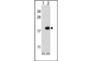 Western blot analysis of FABP2 (arrow) using FABP2 Antibody (N-term) Cat. (FABP2 anticorps  (N-Term))