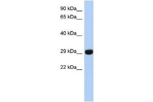 WB Suggested Anti-FN3KRP Antibody Titration: 0. (FN3KRP anticorps  (N-Term))