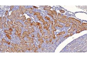 IHC analysis of Sorbitol Dehydrogenase/SORD using anti-Sorbitol Dehydrogenase/SORD antibody (ABIN7602485).