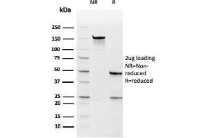 SDS-PAGE Analysis Purified TYMS Recombinant Mouse Monoclonal Antibody (rTYMS/1884). (Recombinant TYMS anticorps  (AA 60-174))