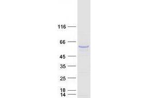 Validation with Western Blot