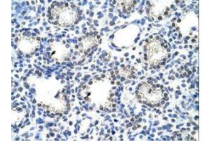 Image no. 1 for anti-Nuclear Receptor Subfamily 2, Group C, Member 1 (NR2C1) (C-Term) antibody (ABIN6736280)