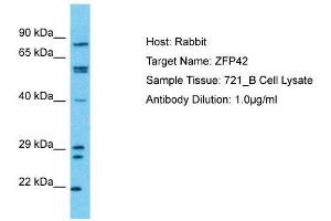 Host:  Rabbit  Target Name:  ZFP42  Sample Type:  721_B Whole cell lysates  Antibody Dilution:  1.