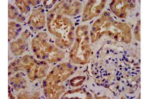 IHC image of ABIN7143948 diluted at 1:300 and staining in paraffin-embedded human kidney tissue performed on a Leica BondTM system.
