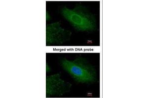 ICC/IF Image Immunofluorescence analysis of paraformaldehyde-fixed HeLa, using Radixin, antibody at 1:200 dilution.