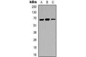 Western blot analysis of IRAK3 expression in LOVO (A), A431 (B), K562 (C) whole cell lysates. (IRAK3 anticorps  (C-Term))