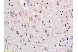 Formalin-fixed and paraffin embedded rat brain tissue labeled with Anti-E2F1 Polyclonal Antibody , Unconjugated at 1:200, followed by conjugation to the secondary antibody and DAB staining (E2F1 anticorps  (AA 101-180))
