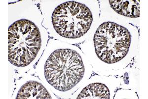 anti-Parkinson Protein 7 (PARK7) (AA 2-189) antibody